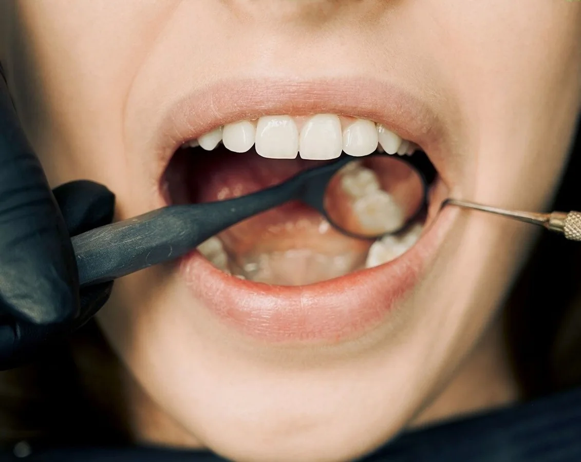 Dental examination of teeth cavity with dental mirror and probe