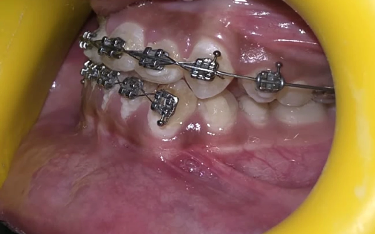 Orthodontic dental care, precision braces and smile alignment
